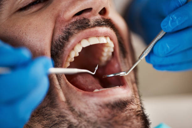 Best Mobile Emergency Dentist in Wink, TX